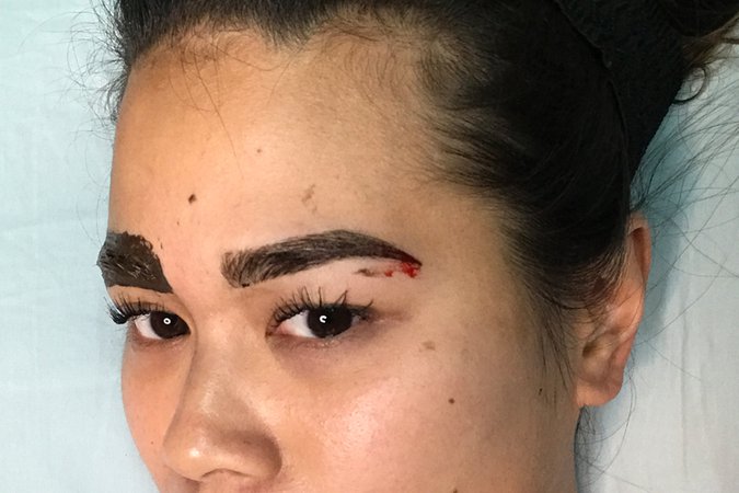 wounded eyebrow - Google Search