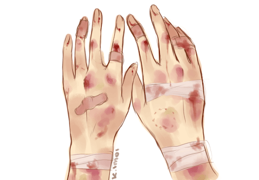 hand with band aids clipart - Google Search