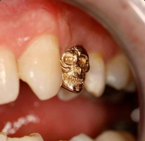 tooth gem gold skull