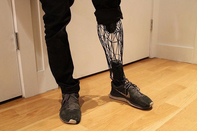 Incredible See-Through Prosthetics 3D-Printed From Titanium | Bored Panda