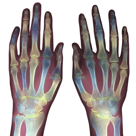 X-ray hands png