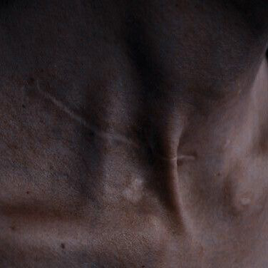 neck scar wound