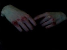 Bloody Knuckles