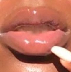 black girl lips