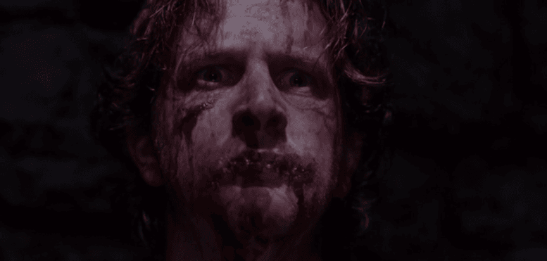 Gabriel - Supernatural face wounds from torture