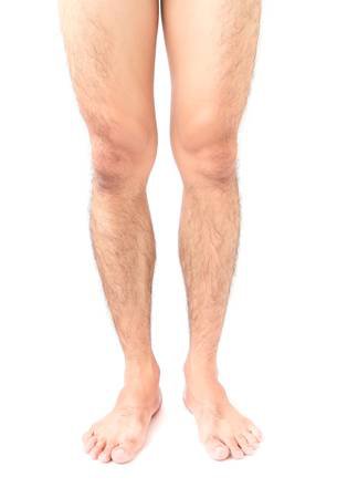 Closeup Legs Men Skin And Hairy With White Background, Health.. Stock Photo, Picture And Royalty Free Image. Image 74573454.