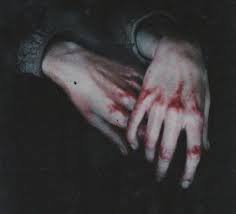 aesthetic bloody knuckles - Google Search
