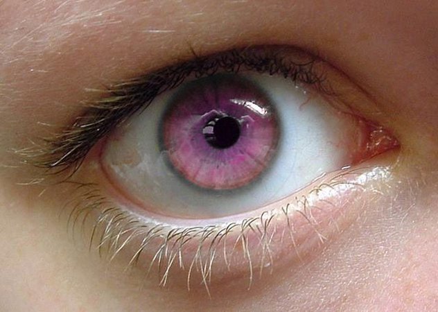 real pink eyes color - Google Search