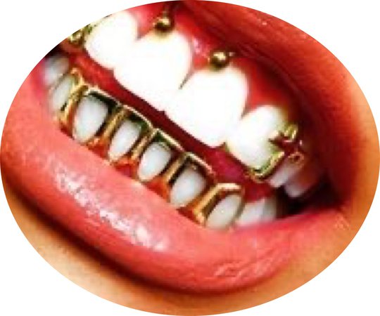 gold grill