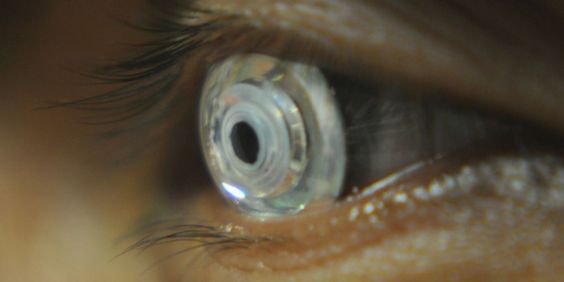 cyborg contact lens
