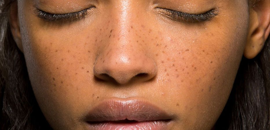 Faux Freckles Are The Beauty Trend Hailing Natural Beauty